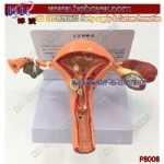 Uterus and ovary models