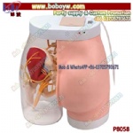 Nursing Model Human Buttocks Intramuscular Injection Model